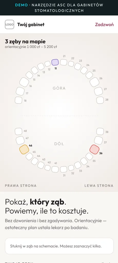 Mapa uśmiechu: schemat zębów z trzema zaznaczonymi zębami i orientacyjną ceną
